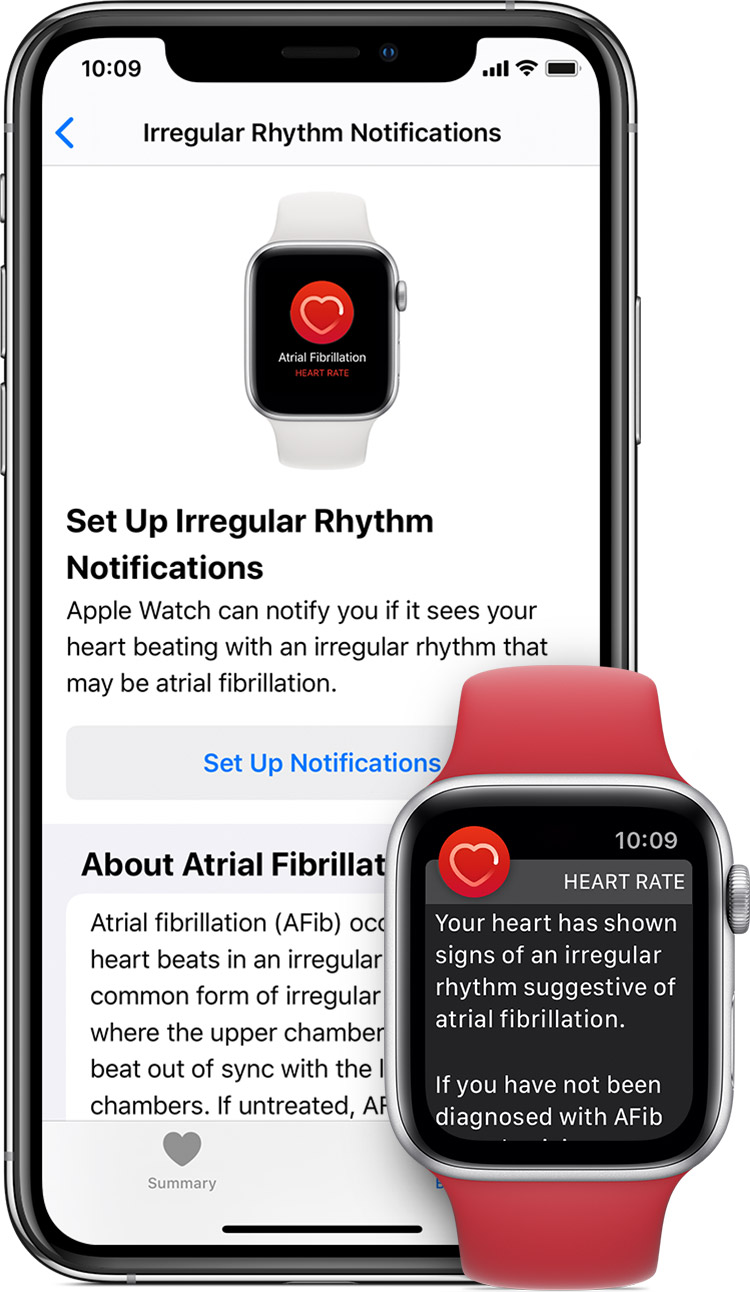 Which Fitness Tracker Alerts When Heart Rate Too High Wearable Fitness Trackers
